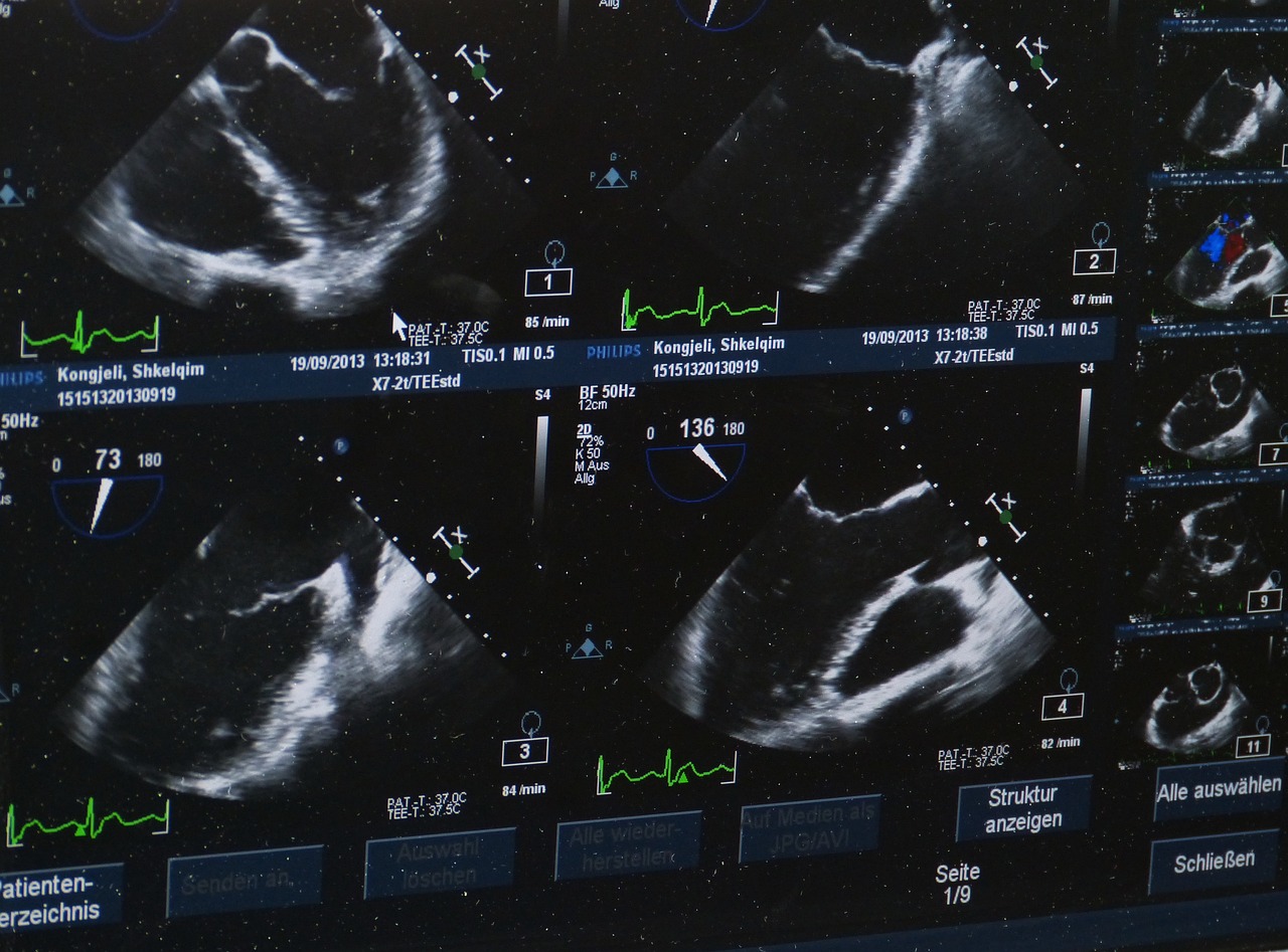 USG Lublin - Jak USG pomogło mi zdiagnozować węzły